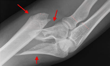 骨科平台安卓版下载安装